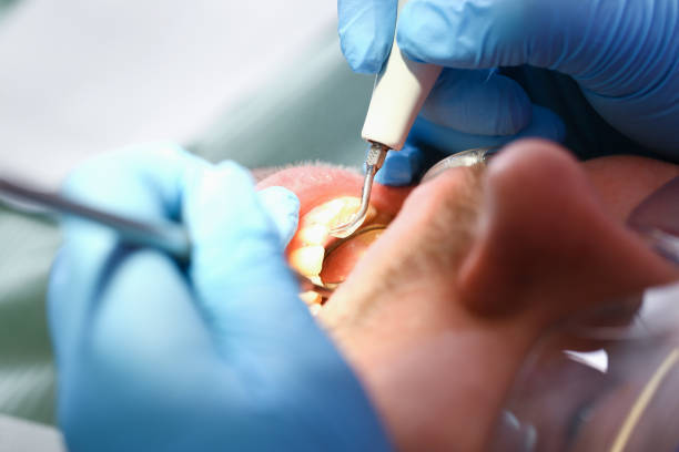Best Pediatric Emergency Dentist in Morristown, IN